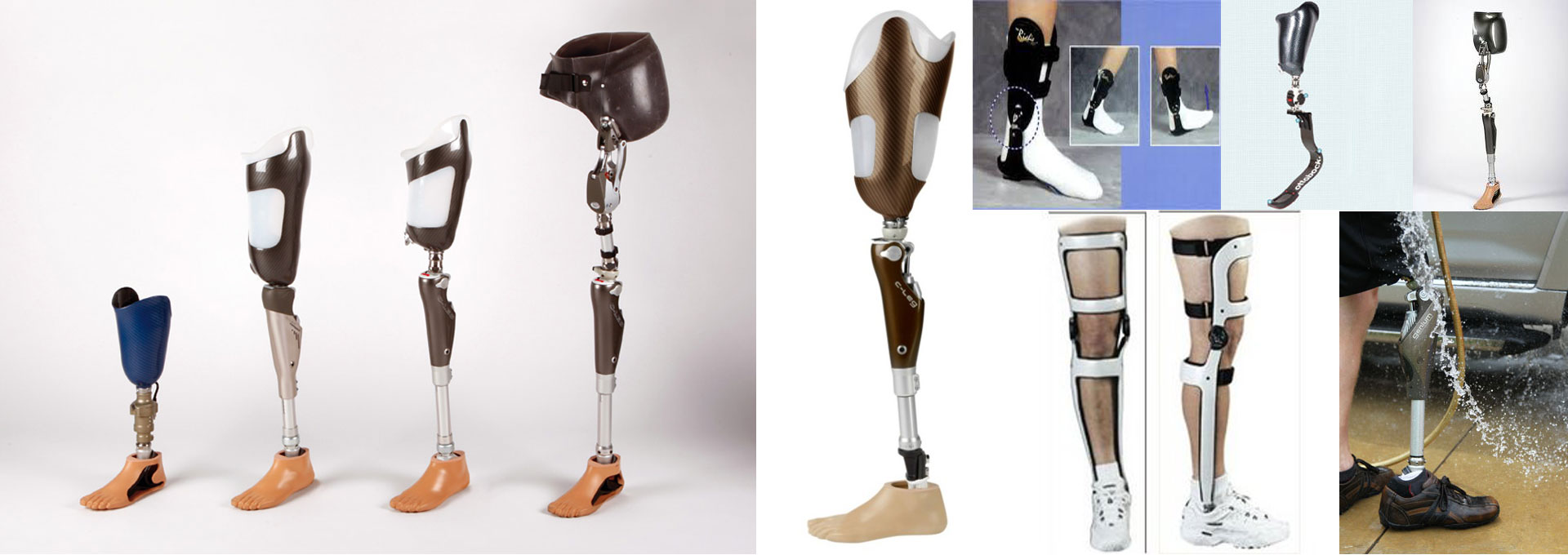 orthopedic in sri lanka - artificial limbs in sri lanka - Matammana Orthopedic Suppliers Company