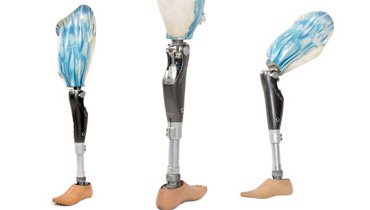 Above Knee Computerised Leg prosthetic System (C-Leg)